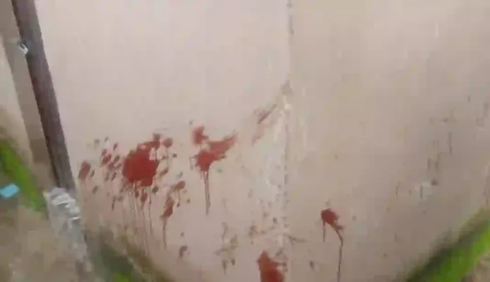 Robber Attacks Poly Student in Bauchi