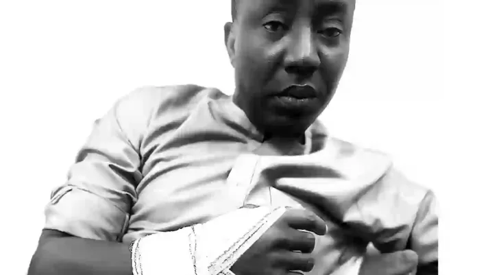 Sowore Broke Arm Sowore Broke Arm