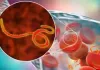 Ebola: FG Names Lagos, Kano, Rivers, Taraba As High Risk States Ebola Virus