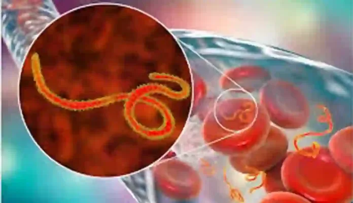 Ebola Virus